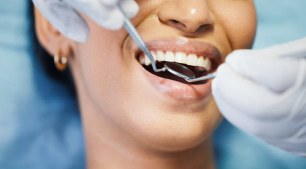 Best Walk-In Emergency Dentist in Cocoa West, FL